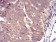 SLINGSHOT-1L Primary Antibody MP30742 [M6C11G9]