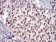 JAK2 Primary Antibody MP30747 [M5C12C9]
