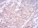 TUBB1 Primary Antibody MP30762 [M2A1A9]