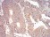 ADD1 Primary Antibody MP30763 [M5D4H1]