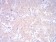 LDLR Primary Antibody MP30767 [M1B10H10]