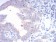 FGFR3 Primary Antibody MP30777 [M2H10B4]