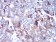 CTSD Primary Antibody MP30778 [M2H4H5]