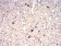 CALB2 Primary Antibody MP30793 [M1F5H1]