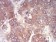 NFKBIA Primary Antibody MP30797 [M4D4C4]