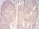 PDPK1 Primary Antibody MP30805 [M7E4G11]