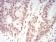 TERT Primary Antibody MP30808 [M3H2C12]