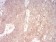 NOX4 Primary Antibody MP30812 [M3H2C4]