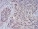 CBX4 Primary Antibody MP30815 [M6C5G3]