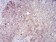 RAB11FIP1 Primary Antibody MP30825 [M1A12B9D8]