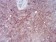 RAB11FIP1 Primary Antibody MP30826 [M3A12H9D2]