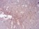 GLI1 Primary Antibody MP30831 [M1B9F8]