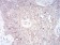 GLI1 Primary Antibody MP30831 [M1B9F8]
