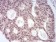 MGMT Primary Antibody MP30837 [M1A11F8]
