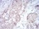 RND3 Primary Antibody MP30838 [M5C7E8]