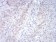 RND3 Primary Antibody MP30839 [M5C7B6]