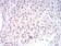 PAX6 Primary Antibody MP30845 [M1F6G2]