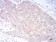 LRP1 Primary Antibody MP30851 [M3F12E2]