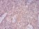 PLCG1 Primary Antibody MP30861 [M3C2D11]