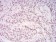 DDX39B Primary Antibody MP30867 [M3A2B2]