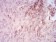 MMP14 Primary Antibody MP30869 [M6A11D1]