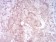 MMP14 Primary Antibody MP30869 [M6A11D1]