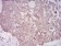 BMP7 Primary Antibody MP30875 [M6E5D12]