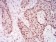 CBX2 Primary Antibody MP30881 [M4C11B10]