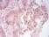 CBX2 Primary Antibody MP30881 [M4C11B10]