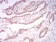 CK5 Primary Antibody MP30891 [M2C8E4]