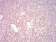 CK5 Primary Antibody MP30892 [M3D6D4]