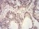 HIST2H3C(27Ac) Primary Antibody MP30900 [M2D7B3]