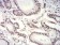 HIST2H3C(27Ac) Primary Antibody MP30901 [M6E7A9]