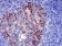 TSHB Primary Antibody MP30942 [M1D12G1]