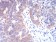 TBCC Primary Antibody MP30962 [M7G6H1]