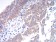 TBCC Primary Antibody MP30962 [M7G6H1]