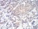 PLCG1 Primary Antibody MP30963 [M3H1C10]
