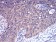 CFHR5 Primary Antibody MP30966 [M3E1E10]