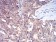 ALDH6A1 Primary Antibody MP30975 [M6H9B7]