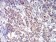 ALDH6A1 Primary Antibody MP30975 [M6H9B7]