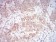 MAP2K3 Primary Antibody MP30978 [M2E12D11]