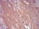 SERPINA1 Primary Antibody MP30982 [M5D1D2]