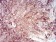 SERPINA1 Primary Antibody MP30982 [M5D1D2]