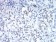 DDX5 Primary Antibody MP30987 [M4F1C12]