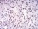 DNMT1 Primary Antibody MP30992 [M2D10G8]