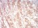 RAN Primary Antibody MP30993 [M8D1A6]