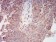 AKT1 Primary Antibody MP30997 [M1F7G2]