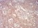 PYCARD Primary Antibody MP31009 [M1C3D7]