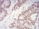 XRN2 Primary Antibody MP31010 [M9F7G11]