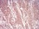 ARF1 Primary Antibody MP31017 [M8D8E9]